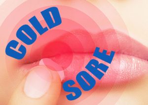Tulsa & Sand Springs dentist, Dr. Emami at Galleria of Smiles tells patients about cold sores – what they are, why they happen, and how to treat them.