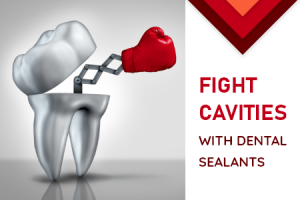 Galleria of Smiles talks about the benefits of dental sealants
