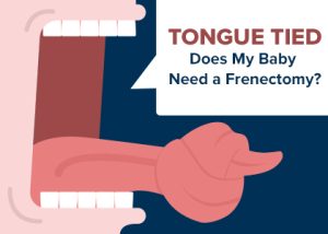 Tulsa & Sand Springs dentists at Galleria of Smiles, discuss different types of frenums, how they can cause problems for your baby’s mouth, and treatment with frenectomy.