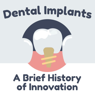 Tulsa dentist, Dr. Emami of Galleria of Smiles discusses dental implants and shares some information about their history.