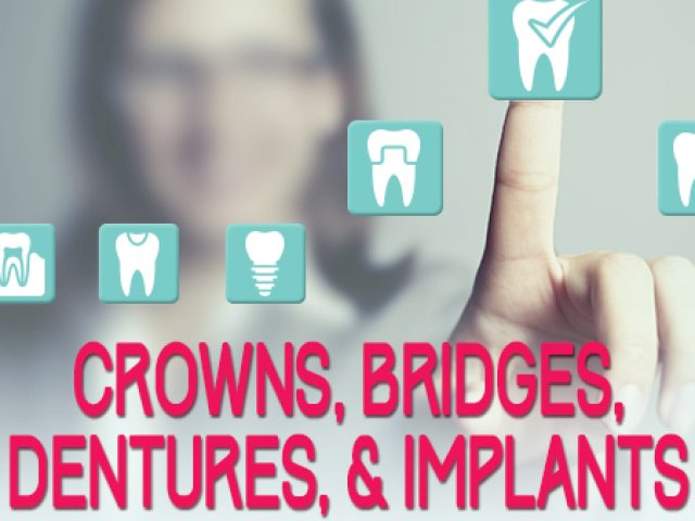Crowns, Bridges, Dentures & Implants: The Facts (featured image)