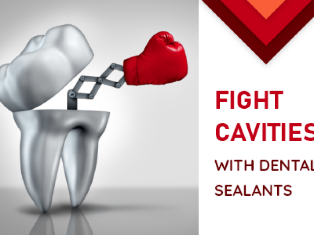 How to use Dental Sealants to Fight Cavities (featured image)