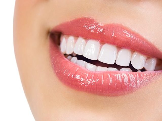 Why Teeth Cleanings Are Important (featured image)