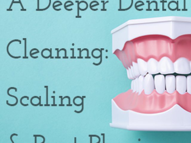 A Deeper Dental Cleaning: Scaling & Root Planing (featured image)