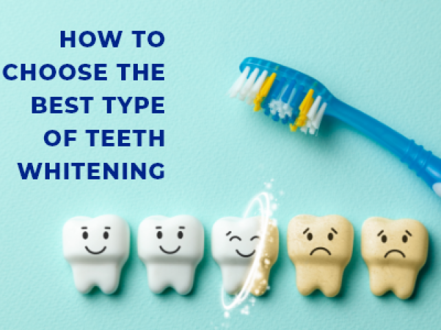 How To Choose The Best Type Of Teeth Whitening (featured image)