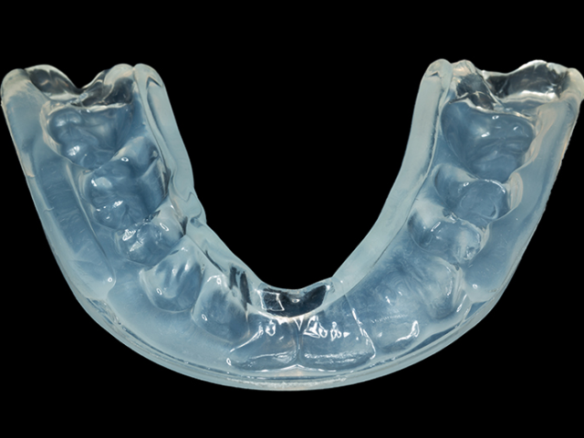 What Are Mouthguards? (featured image)