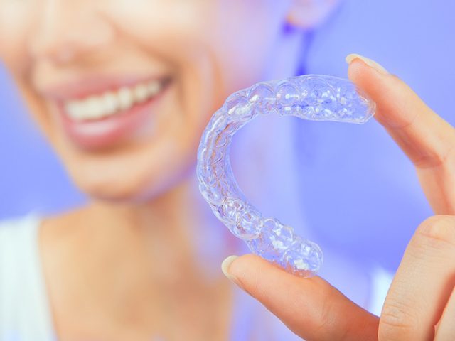 Your Guide to At-Home Teeth Whitening (featured image)