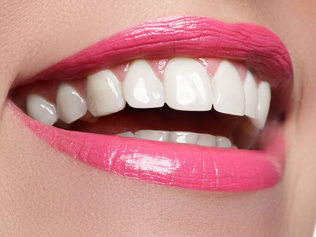 Porcelain Veneers Can Give You a Hollywood Smile (featured image)